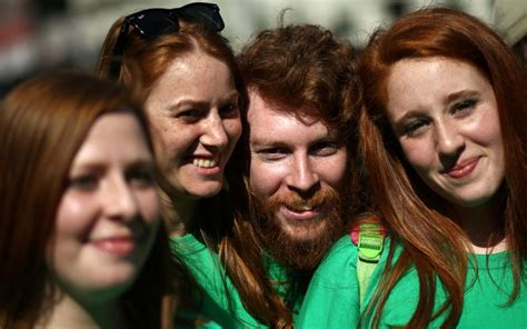 Fact Or Fiction Do Redheads Feel More Pain Pbs Newshour