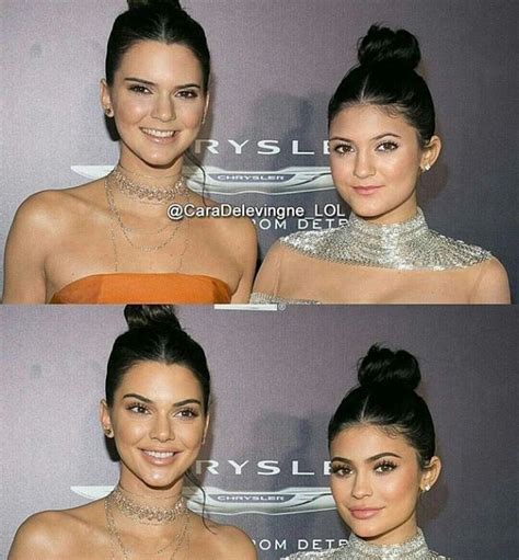 Kendall And Kylie Jenner Plastic Surgery Kylie Jenner Plastic Surgery