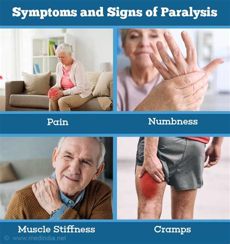 Causes Symptoms And Signs Of Paralysis