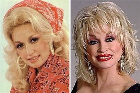 dolly parton s plastic surgery the many procedures she had done rocking vegas to pieces