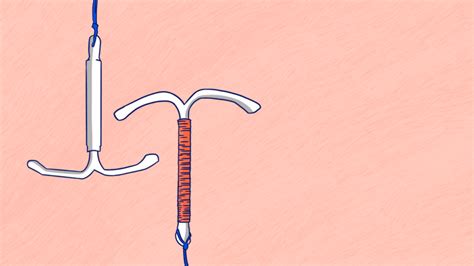 The Coil What Is The Difference Between An Iud And An Ius Spunout