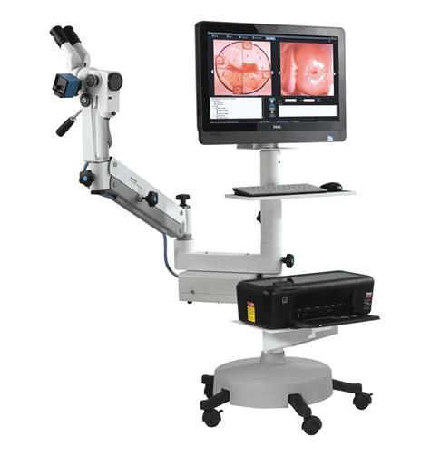 Kernel Colposcopio Colposcope For Gynecology Optical Hd Camera System