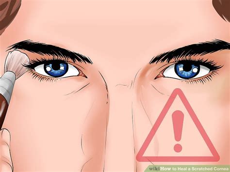 Treatments for a scratched cornea can include wearing a patch, wearing a bandage contact lens and using antibiotic drops several times a day until the. How to Heal a Scratched Cornea (with Pictures) - wikiHow