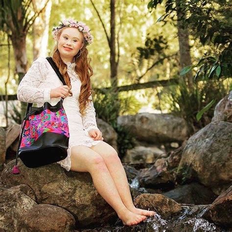 Get To Know The Beautiful Model With Down Syndrome Who Just Landed 3