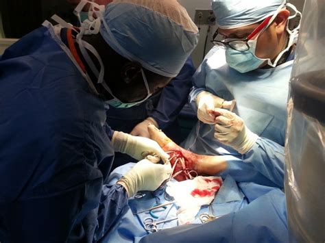 This procedure will restore the normal function of joints or the. 10 best peroneal tendon surgery images on Pinterest ...