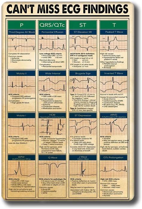 Cardiology Doctor Nurse Poster Cant Miss Ecg Findings