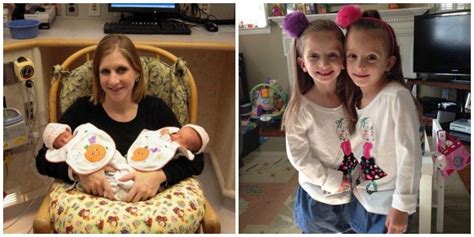 a beautiful gallery of preemie twins before and after twiniversity