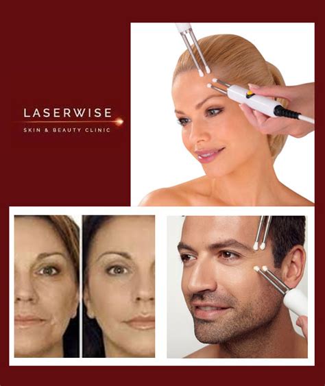 Non Surgical Face Lift Cardiff Caci Laserwise Clinic