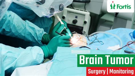 Brain Tumor Surgery Neurosurgery Patient Testimonial Brain