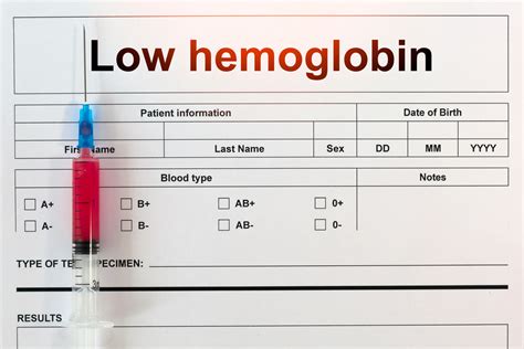 Ten Reasons Your Hemoglobin Might Be Low Facty Health