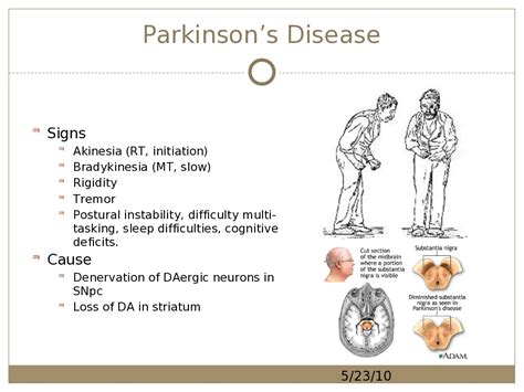 There is strong evidence that it first affects the dorsal motor nucleus of the vagus nerve and the olfactory bulbs and nucleus, then the locus coeruleus, and eventually the substantia nigra. 20-CS-110 : Parkinson's Disease