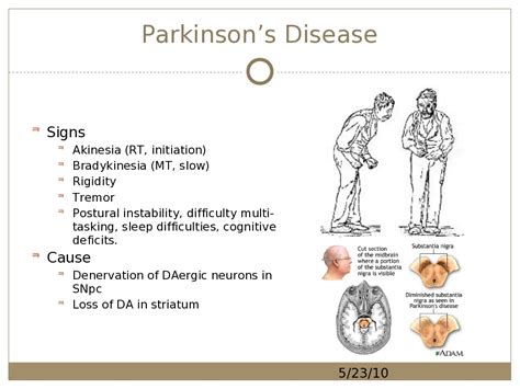 Parkinson's disease is an increasingly common disease of elderly patients who present a particular anaesthetic challenge. 20-CS-110 : Parkinson's Disease