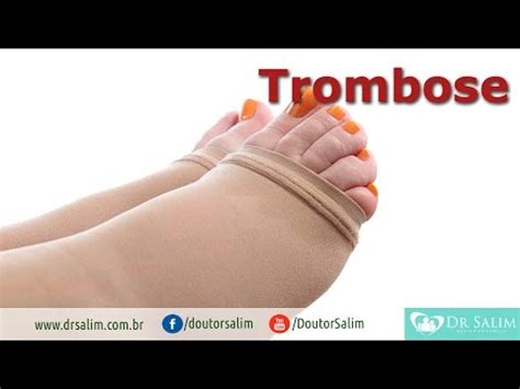 Cuidados Com A Trombose Dr Salim CRM 43 163 YouTube