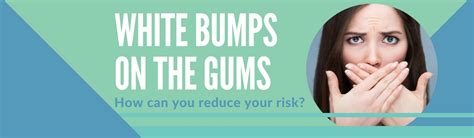 White Bumps On Gums What Is It And How Do You Treat It