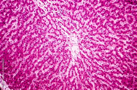 Light Micrograph Of A Liver Showing Cords Made From Hepatocytes And
