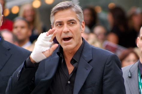 George Clooney Hospitalized After Car Hits His Scooter In