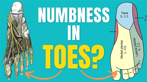 5 Causes Of Numbness In Toes How To Treat Numbness In Toes
