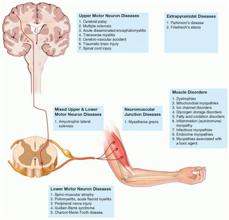 Neuromuscular Diseases Musculoskeletal Key