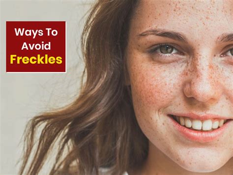 Freckles Prevention Tips Heres How You Can Prevent These Beauty Spots Onlymyhealth