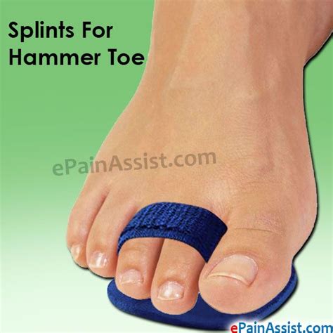 Hammer Toe Treatment Without Surgery Hammer Toe Hammer Toe