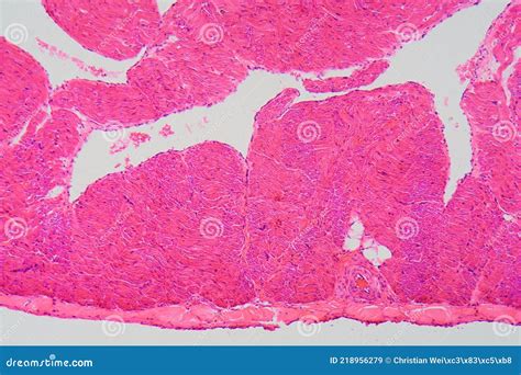 Atrial Wall Of A Human Heart In The Microscope Royalty Free Stock Photo