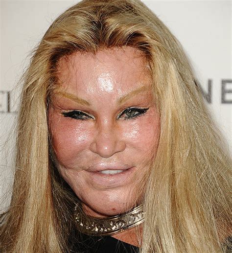 Plastic Surgery Pictures That Will Scare You Wtf Gallery Ebaums World