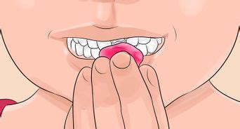 Your doctor uses a piece of metal to bond two neighboring teeth. How to Pull Out a Tooth Without Pain: 11 Steps (with Pictures)
