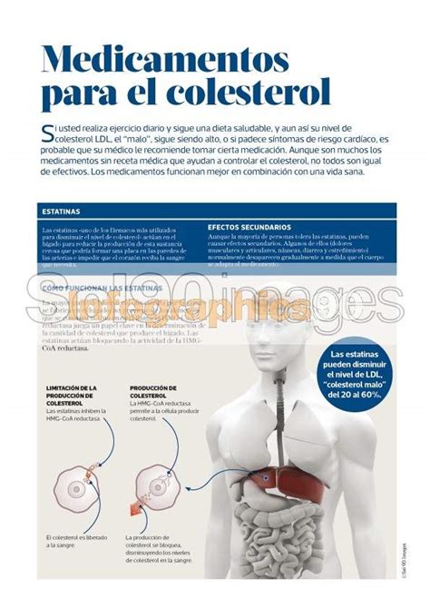 Infografía Medicamentos Para El Colesterol Infographics90