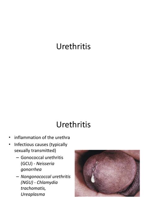 Urethritis Candidiasis Rtt