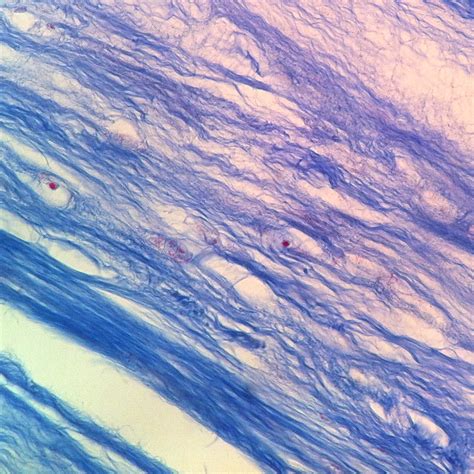 Fibrocartilage Connective Tissue Under Microscope Micropedia