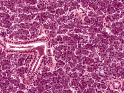 Parotid Gland Lm Stock Image C0305187 Science Photo Library