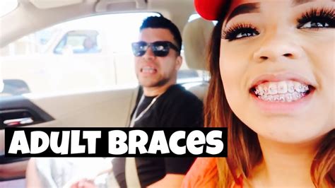 Married Couple Gets Braces Youtube