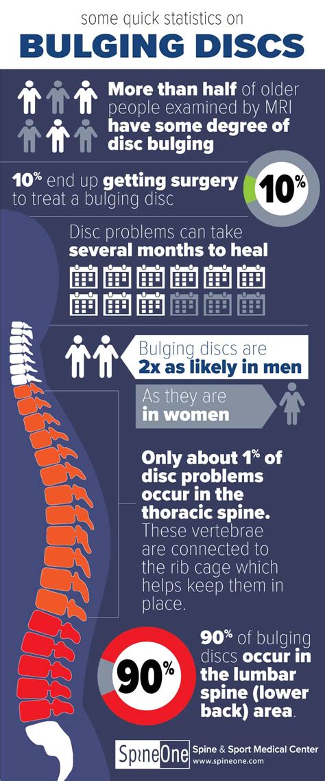 Bulging Disc Infographic Statistics And Patterns Spineone