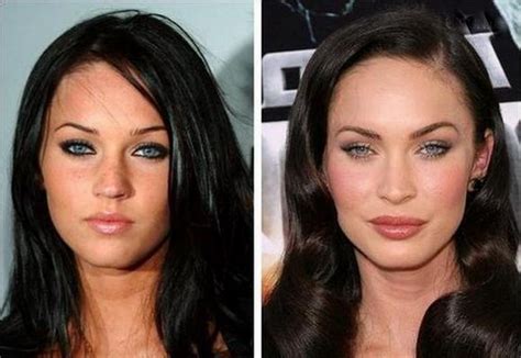 Hollywood Hot Celebrities With Plastic Surgery Cosmetic Surgery