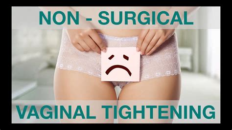 Non Surgical Vaginal Tightening Youtube