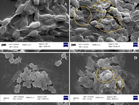 Scanning Electron Microscopy Sem Images Of A Dead And Shriveled