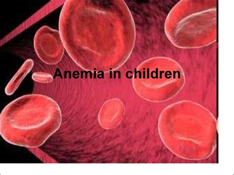 Anemia In Children презентация онлайн