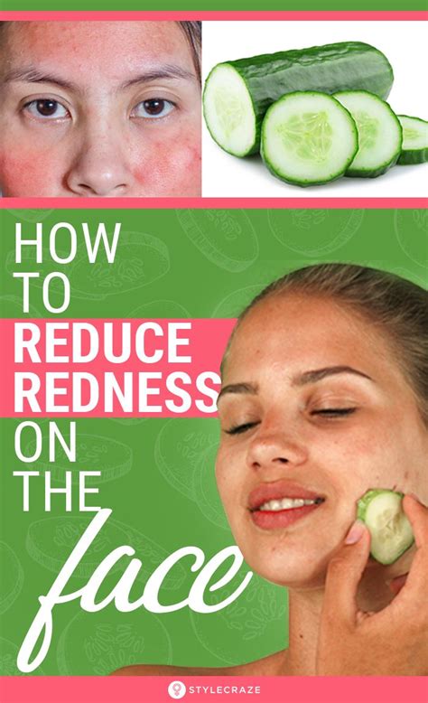 Home Remedies To Get Rid Of Redness On The Face Redness On Face