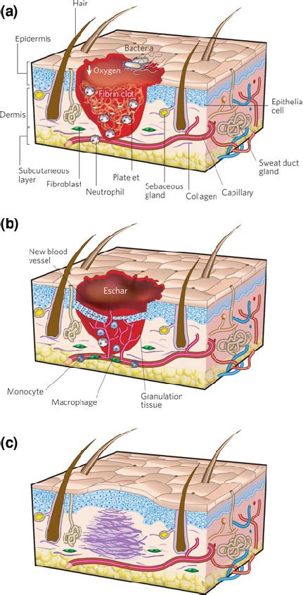 Schematic Representation Of The Phases Of Wound Healing A Infiltration