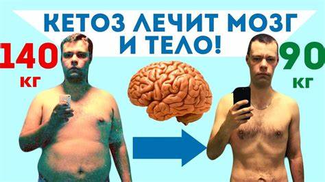 Дерматит нервный диета