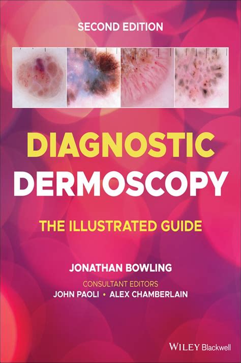 Diagnostic Dermoscopy 2nd Ed By Jonathan Bowling Ebook