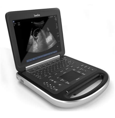 Understand Sonosite Portable Ultrasounds Part Ii Ame Ultrasounds