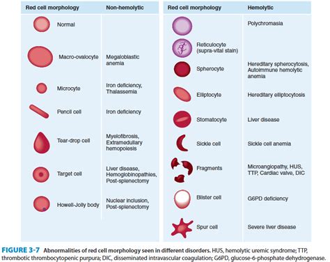 Abnormal Red Blood Cell Morphology Pictures To Pin On Pinterest Pinsdaddy