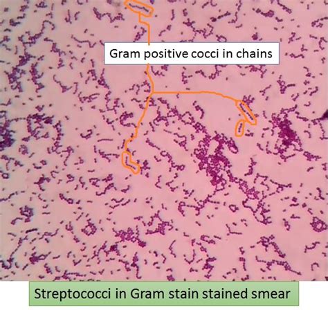 Streptococci In Gram Stain Showing Gram Positive Cocci In Chains As Shown