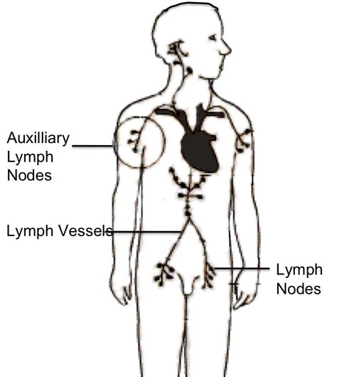 Post Mastectomy Lymphoedema