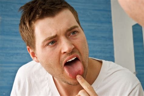 Жжение в горле во рту и на языке основные причины диагностика и тактика лечения меры