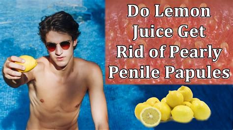 Do Lemon Juice Get Rid Of Pearly Penile Papules Here Is The Truth