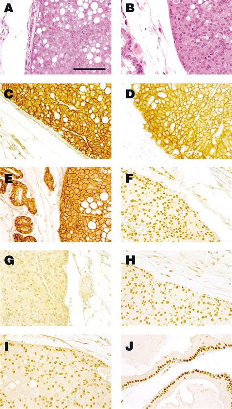 Androgen Dependent Mammary Carcinogenesis In Rats Transgenic For The