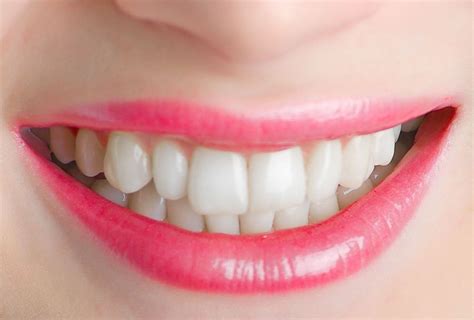 Do not bite food with incisor teeth (front teeth), but with teeth a bit more to the sides, around the canines and kisorlok, and use both sides of the denture at the same time while chewing! The right kind of chewing gum lowers the risk of tooth decay