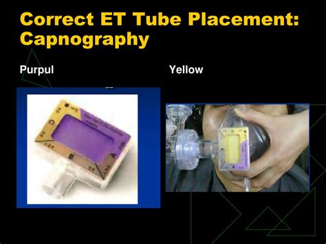 Rapid detection of oesophageal intubation: PPT - AIRWAY MANAGEMENT PowerPoint Presentation, free ...